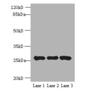 WB analysis of (1) K562, (2) 293T and (3) HeLa whole cell lysates, using EXOSC5 antibody (5 µg/ml). Predicted band size: 25 kDa, Observed band size: 25 kDa.