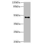 Western blot analysis of PC-3 whole cell lysates, using AADACL2 antibody (2 µg/ml) and Goat anti-Rabbit polyclonal secondary antibody (1/10000 dilution).