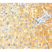 IHC-P analysis of human liver tissue, using Glucose-6-Phosphatase, Catalytic (G6PC) antibody (1/100 dilution).