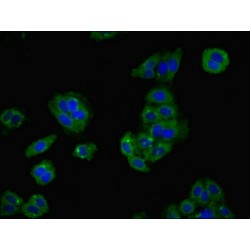 Lymphocyte Antigen 6H (LY6H) Antibody