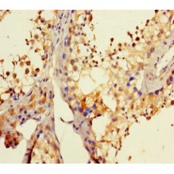 DEAD/H (Asp-Glu-Ala-Asp/His) Box Polypeptide 35 (DHX35) Antibody