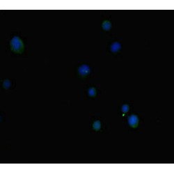 E1A Binding Protein P300 (EP300) Antibody