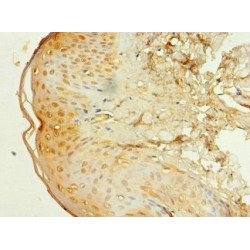 E1A Binding Protein P300 (EP300) Antibody