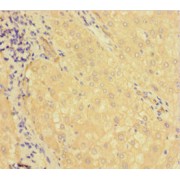 IHC-P analysis of human liver tissue, using KDM1B Antibody (1/100 dilution).