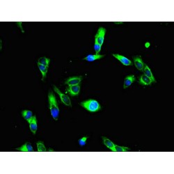 Histone Deacetylase 10 (HDAC10) Antibody