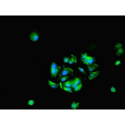 Histone Deacetylase 10 (HDAC10) Antibody