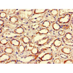 Histone Deacetylase 10 (HDAC10) Antibody