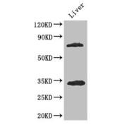 WB analysis of Mouse liver tissue, using HDAC10 Antibody (3.4 µg/ml). Predicted band size: 44 kDa, 70 kDa, 71 kDa and 72 kDa; Observed band size: 34 kDa, 72 kDa.