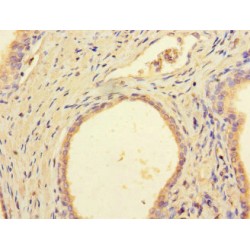 DDB1 And CUL4 Associated Factor 8 (DCAF8) Antibody