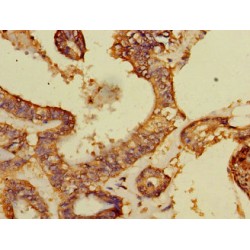 DDB1 And CUL4 Associated Factor 8 (DCAF8) Antibody