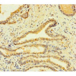 Fc Fragment of IgE, High Affinity I, Receptor (FCER1A) Antibody