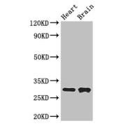 WB analysis of mouse heart tissue and mouse brain tissue, using FCER1A antibody (3 µg/ml). Predicted band size: 30 kDa, Observed band size: 30 kDa.