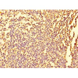 Fidgetin (FIGN) Antibody