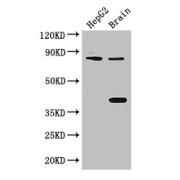 WB analysis of (1) HepG2 whole cell lysates, and (2) mouse brain tissue, using FIGN antibody (3 µg/ml). Calculated MW: 83 kDa, Observed MW: 83, 38 kDa.