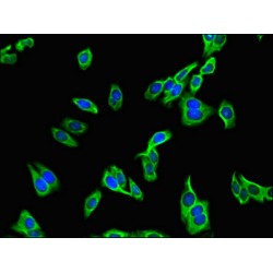 E3 Ubiquitin-Protein Ligase PDZRN3 (PDZRN3) Antibody