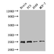 WB analysis of (1) Mouse Brain Tissue, (2) PC3 whole cell lysates, (3) A549 whole cell lysates, and 4) MCF-7 cell lysates, using APOPT1 Antibody (2.7 µg/ml). Calculated MW: 25 kDa, Observed MW: 25 kDa.