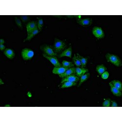 Interferon Induced Protein 44-Like (IFI44L) Antibody