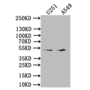 Western blot analysis of U251 and A549 whole cell lysates, using IFI44L antibody (1/1000 dilution). <p></p>Calculated MW: 51.3 kDa, Observed band size: 52 kDa.