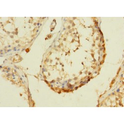 DEAD/H (Asp-Glu-Ala-Asp/His) Box Polypeptide 32 (DHX32) Antibody