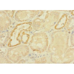 DEAD/H (Asp-Glu-Ala-Asp/His) Box Polypeptide 32 (DHX32) Antibody