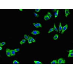 Beta-1 Adrenergic Receptor (ADRB1) Antibody