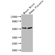WB analysis of Mouse brain tissue lysate and Human placenta tissue lysate using ADRB1 antibody (1/1000 dilution) with Goat anti-Rabbit IgG polyclonal antibody (1/50000 dilution). Calculated MW: 52 kDa, Observed MW: 52 kDa.
