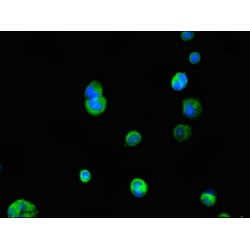 Interleukin 23 Receptor (IL23R) Antibody