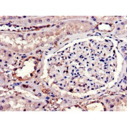 Interleukin 23 Receptor (IL23R) Antibody