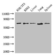 WB analysis of (1) NIH/3T3 whole cell lysate, (2) K562 whole cell lysate, (3) mouse liver tissue, (4) mouse lung tisue, and (5) mouse spleen tissue, using IL23R antibody (3.4 µg/ml). Calculated MW: 21, 26, 31, 41, 43, 72 kDa, Observed MW: 72 kDa.