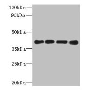 WB analysis of (1) MCF-7 whole cell lysate, (2) A549 whole cell lysate, (3) HeLa whole cell lysate, and (4) Mouse heart tissue, using MAGEB18 antibody (12 µg/ml). Predicted band size: 39 kDa, Observed band size: 39 kDa.