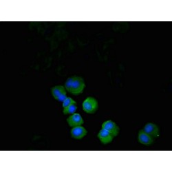 Programmed Cell Death Protein 1 (PDCD1) Antibody