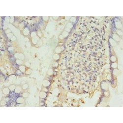 Programmed Cell Death Protein 1 (PDCD1) Antibody