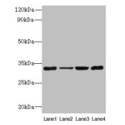 WB analyssis of (1) 293T cell lysates, (2) HeLa cell lysates, and (3) Mouse Stomach tissue, using PDCD1 antibody (6 µg/ml). Calculated band size: 32 kDa, Observed band size: 32 kDa.