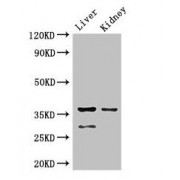 WB analysis of mouse liver and mouse kidney tissue, using PPP2CA antibody (2.5 µg/ml). Predicted band size: 36, 30 kDa. Observed band size: 36, 30 kDa.
