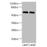 WB analysis of (1) Mouse spleen tissue, and (2) Mouse skeletal muscle tissue, using PNPLA1 antibody (12 µg/ml) and goat anti-rabbit IgG secondary antibody (1/10000 dilution). Predicted band size: 48, 49, 58 kDa, Observed band size: 58 kDa.