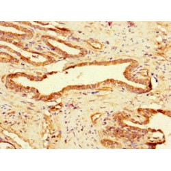 Lysosomal Alpha Glucosidase (GAA) Antibody