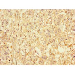 Lysosomal Alpha Glucosidase (GAA) Antibody