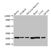 WB analysis of (1) Mouse brain tissue, (2) Mouse stomach tissue, (3) Mouse skeletal muscle tissue, (4) Rat heart tissue, (5) Rat liver tissue, and (6) Rat spleen tissue, using Fgf15 antibody (3.5 µg/ml). Predicred band size: 26 kDa. Observed band size: 26 kDa.