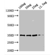 Western blot analysis of recombinant PMP20/ASPF3, using PMP20/ASPF3 Antibody (3.25 µg/ml) and Goat anti-Rabbit IgG (1/50,000 dilution). Predicted band size: 35 kDa. Observed band size: 35 kDa.