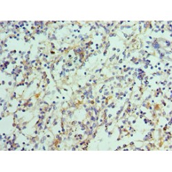 Interleukin 21 (IL21) Antibody