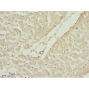 IHC-P analysis of human heart tissue, using RAC3 antibody (1/100 dilution).