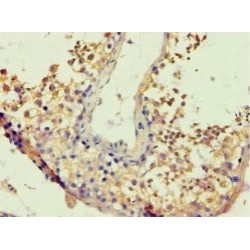 BTB And CNC Homolog 1 (BACH1) Antibody