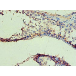 Isocitrate Dehydrogenase [NADP] Cytoplasmic (IDH1) Antibody