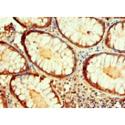 Isocitrate Dehydrogenase [NADP] Cytoplasmic (IDH1) Antibody