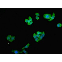 ST8 Alpha-N-Acetyl-Neuraminide Alpha-2,8-Sialyltransferase 2 (ST8SIA2) Antibody