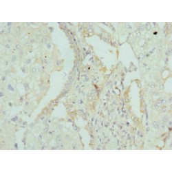 Apolipoprotein M (APOM) Antibody