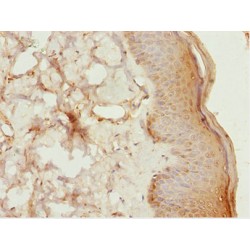 LIM/Homeobox Protein Lhx6 (LHX6) Antibody