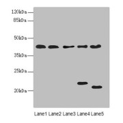 WB analysis of (1) HepG2 whole cell lysate, (2) U87 whole cell lysate, (3) NIH/3T3 whole cell lysate, (4) Mouse brain tissue, and (5) Mouse liver tissue, using LHX6 antibody (3.02 µg/ml). Calculated MW: 20, 39, 41, 42, 44 kDa, Observed MW: 20, 22, 44 kDa.