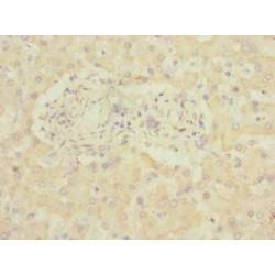 Adhesion G Protein-Coupled Receptor G6 (ADGRG6) Antibody