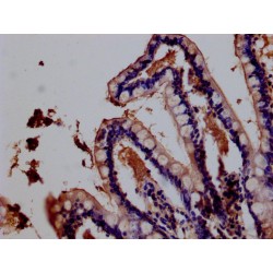 Interferon Lambda Receptor 1 (IFNLR1) Antibody
